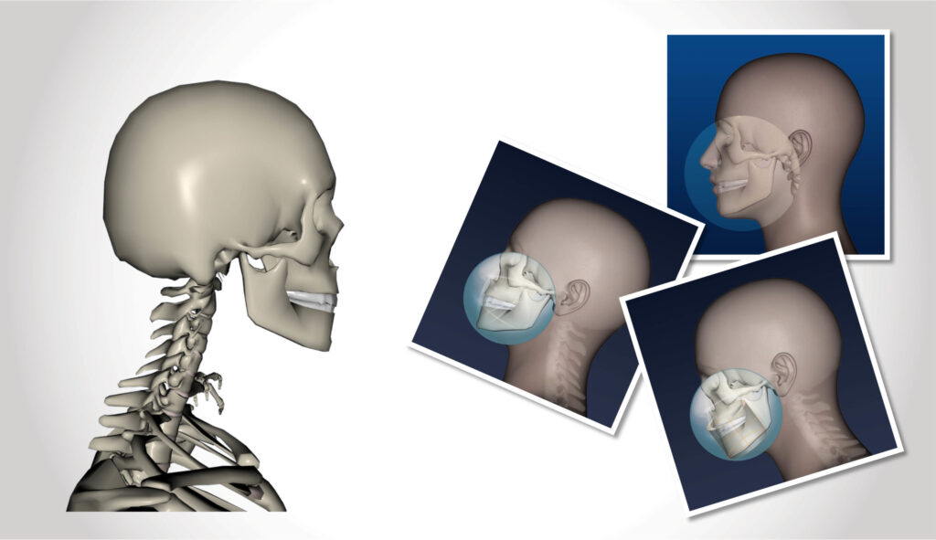 Arrangement von Bildern zur Branche Medizin: ein virtuelles Skelett; Seitansichten von virtuellen Köpfen, bei denen mit Kreisausschnitten Details der menschlichen Anatomie im Kieferbereich sichtbar werden.